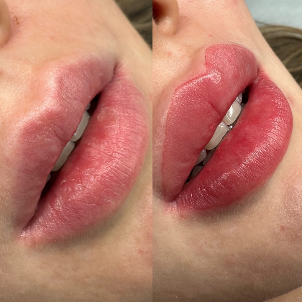 Maquillage semi-permanent lèvres avant après à Nice — Samantha Esthétique